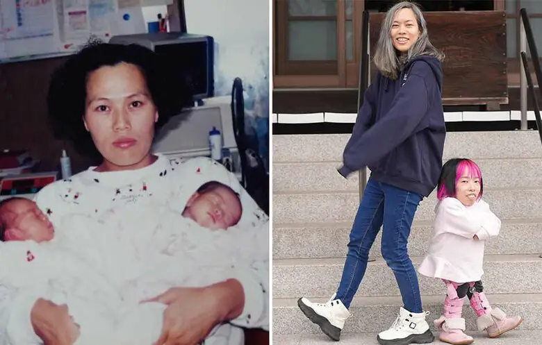 媽媽抱著剛出生的兩姐妹(左)；菊池姐妹身高相差了75公分。翻攝自《金氏世界紀錄》官網