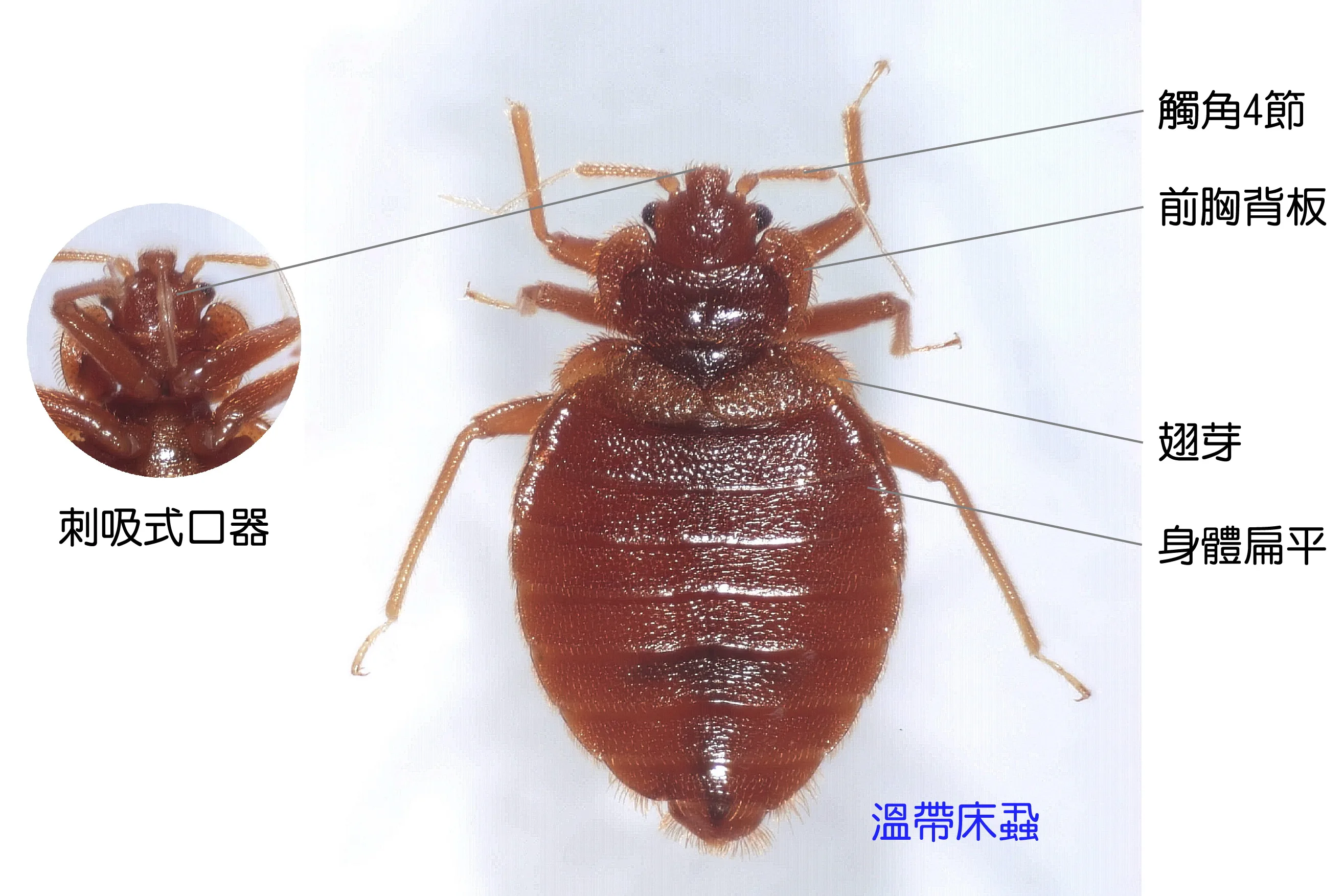 韓國也爆床蝨危機　政府加強蟲害防治措施