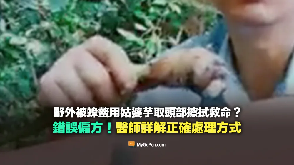 【錯誤】野外被蜂螫用姑婆芋取頭部擦拭救命？醫師詳解正確處理方式