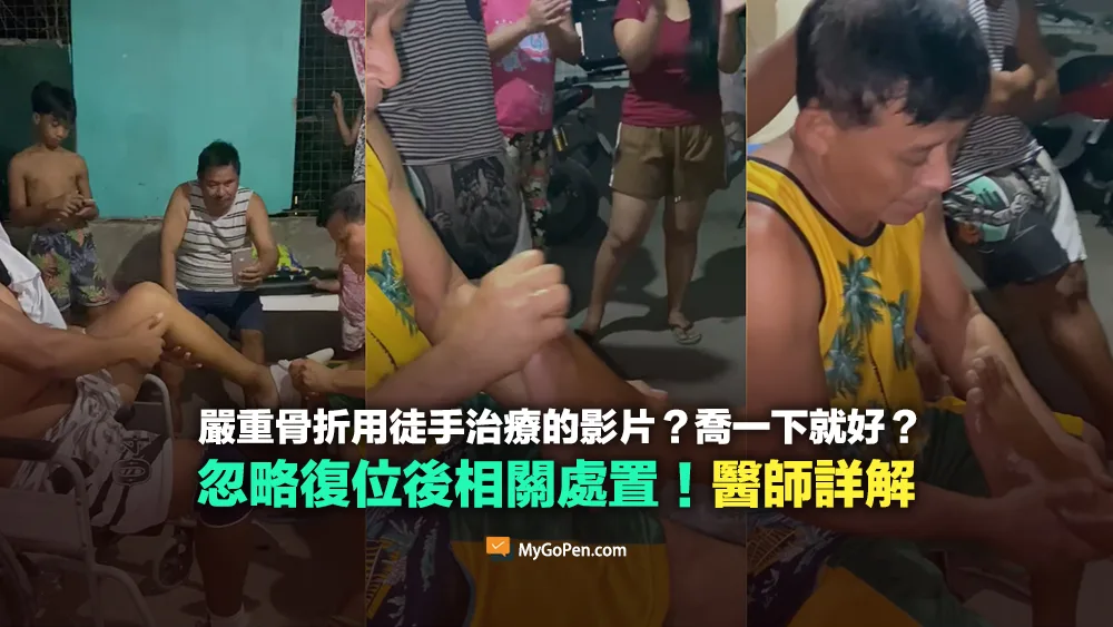 【易誤解】網傳嚴重骨折用徒手治療的影片？忽略復位後相關處置！醫師詳解