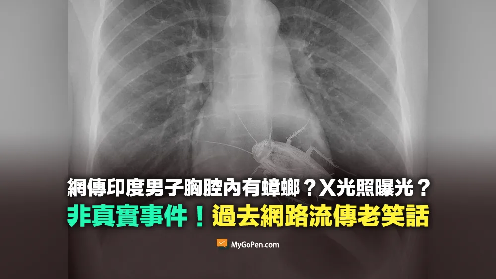【錯誤】印度男子胸腔內有蟑螂？X光照曝光？非真實照片！流傳多年的老笑話