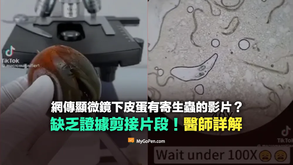 【錯誤】網傳顯微鏡下皮蛋有寄生蟲的影片？剪接缺乏證據！專家詳解