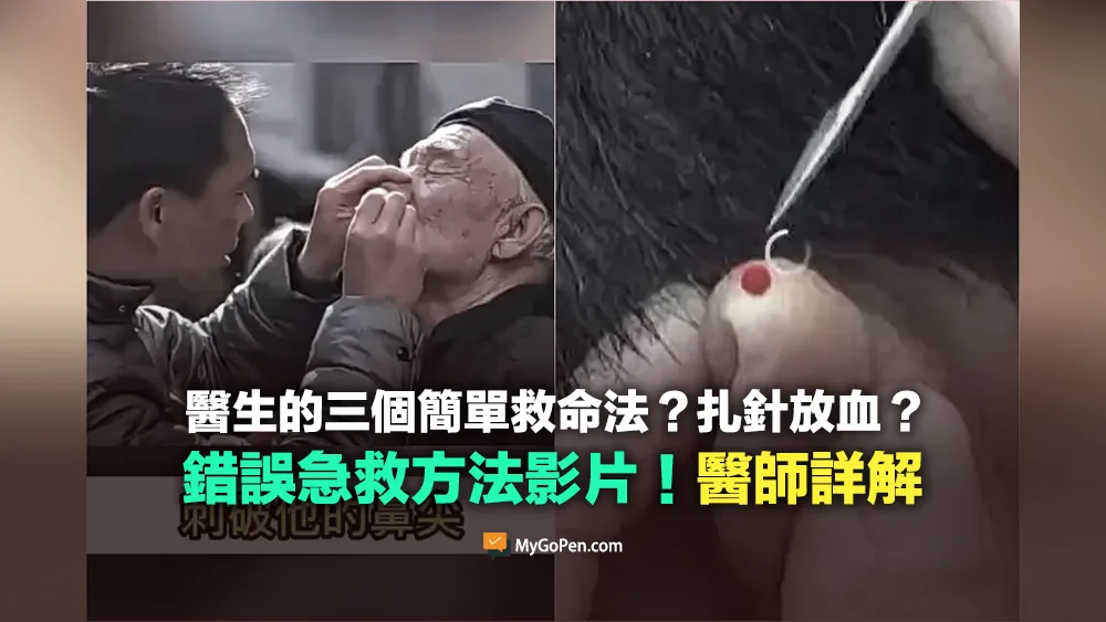 【錯誤】網傳醫生的三個簡單救命法？扎針放血？不實影片！醫師詳解