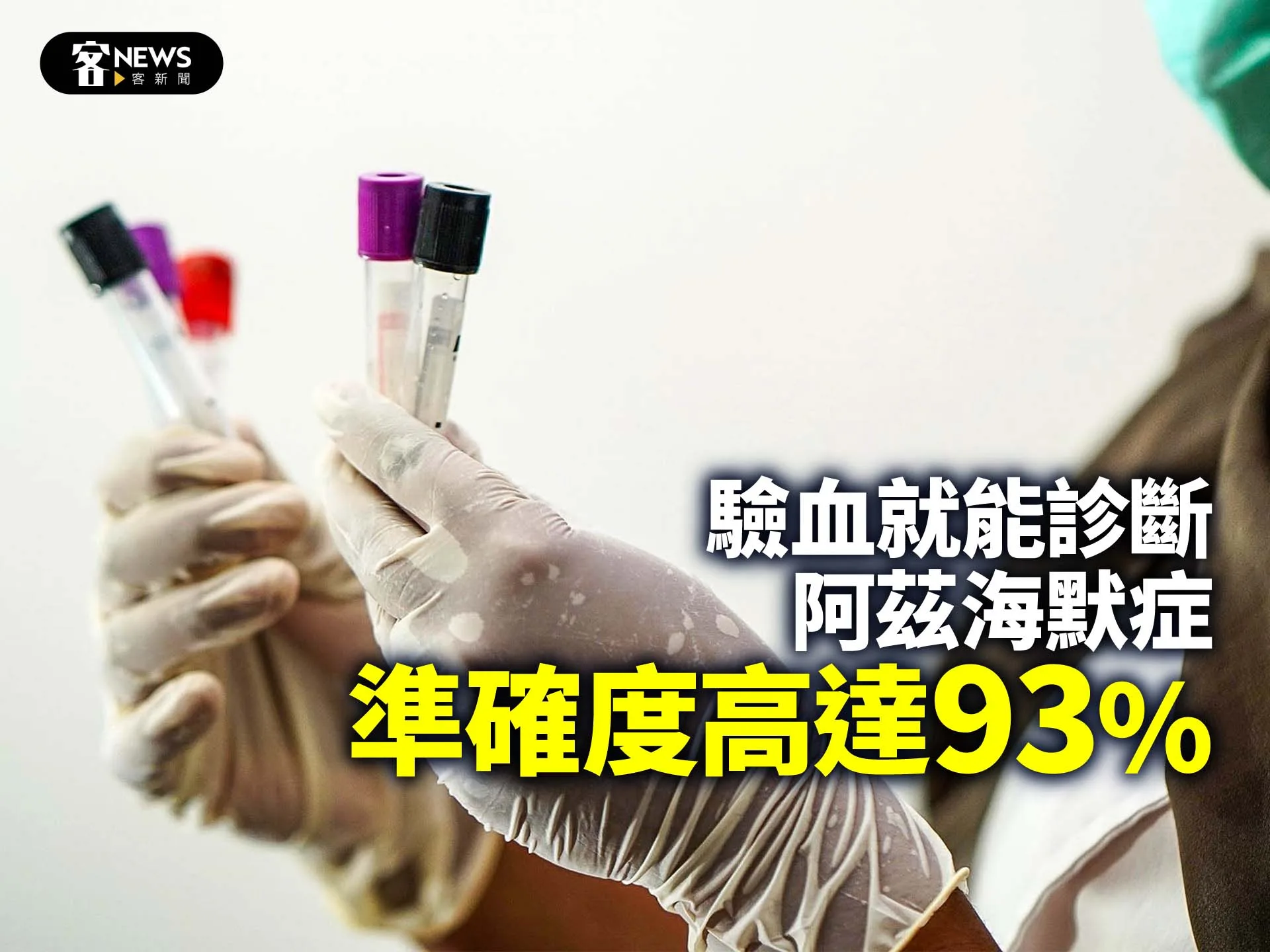 驗血就能診斷阿茲海默症　準確度高達93%