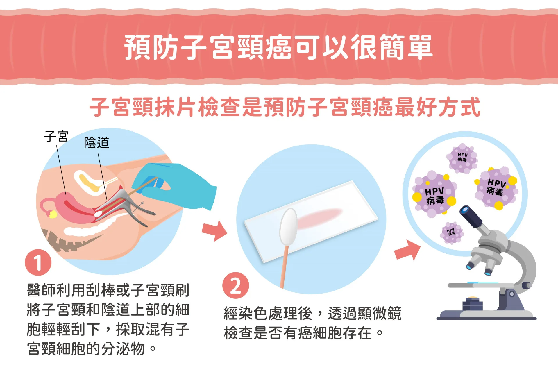 子宮頸癌防治與篩檢圖表。臺北市政府衛生局提供