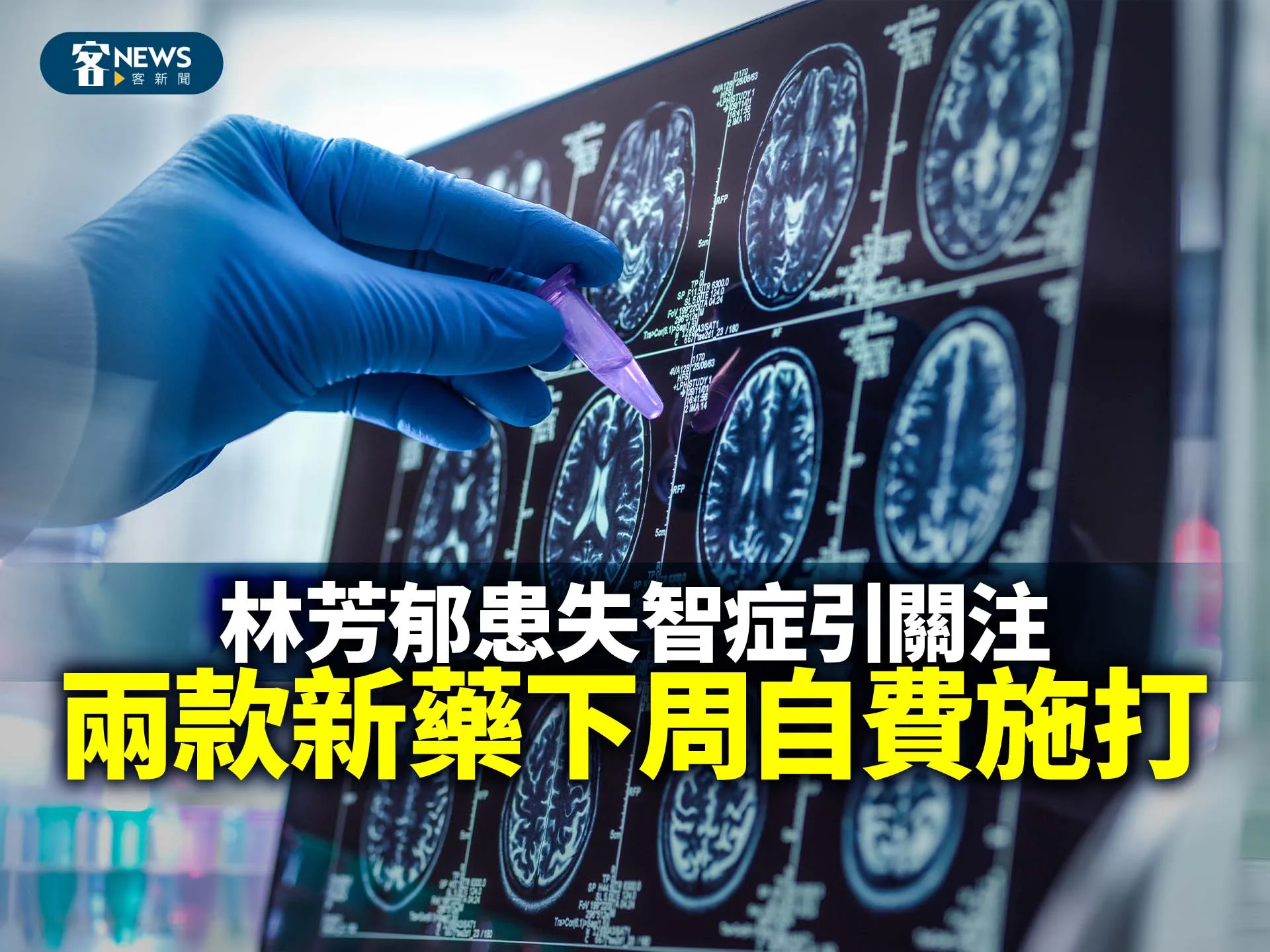 林芳郁患失智症引關注　兩款新藥下周自費施打