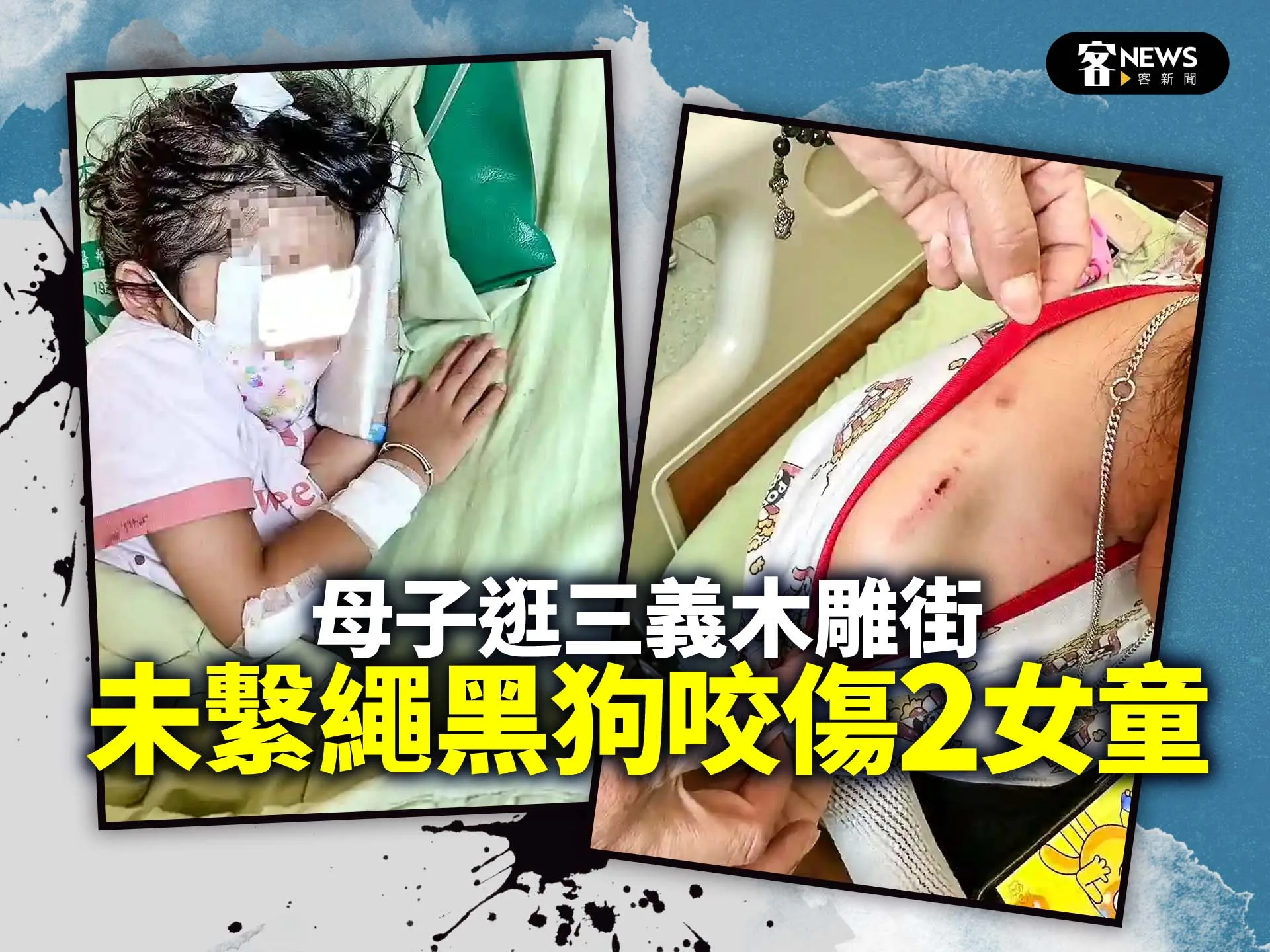 母子逛三義木雕街　未繫繩黑狗咬傷2女童